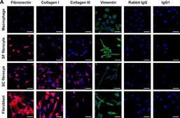 Anti-Fibronectin antibody produced in rabbit affinity isolated antibody, buffered aqueous solution