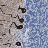 Anti-ITPR1 antibody produced in rabbit Prestige Antibodies® Powered by Atlas Antibodies, affinity isolated antibody, buffered aqueous glycerol solution