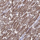 Anti-CRYAB antibody produced in rabbit Prestige Antibodies® Powered by Atlas Antibodies, affinity isolated antibody, buffered aqueous glycerol solution