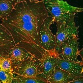 肌动蛋白细胞骨架/黏着斑染色试剂盒 The Actin Cytoskeleton &amp; Focal Adhesion Staining Kit consists of TRITC-conjugated phalloidin, anti-Vinculin &amp; DAPI for the immunofluorescent staining of actin filaments in the cytoskeleton as well as the nucleus of the cells.