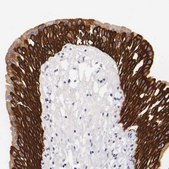 Anti-KRT17 antibody produced in rabbit Ab2, Prestige Antibodies® Powered by Atlas Antibodies, affinity isolated antibody, buffered aqueous glycerol solution