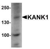 Anti-KANK1 antibody produced in rabbit affinity isolated antibody, buffered aqueous solution