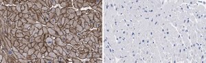 Anti-Laminin B2 Antibody, clone 1B9 ZooMAb® Rabbit Monoclonal recombinant, expressed in HEK 293 cells