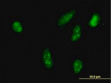 Monoclonal Anti-RPS6KA2 antibody produced in mouse clone 1F6, purified immunoglobulin, buffered aqueous solution