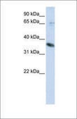 Anti-ST6GALNAC1 antibody produced in rabbit affinity isolated antibody