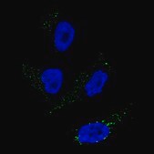 Monoclonal Anti-TYRP1 antibody produced in mouse Prestige Antibodies® Powered by Atlas Antibodies, clone CL4923, purified immunoglobulin, buffered aqueous glycerol solution