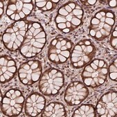 Anti-STAT3 antibody produced in rabbit Prestige Antibodies® Powered by Atlas Antibodies, affinity isolated antibody, buffered aqueous glycerol solution