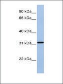 Anti-SLC25A28 antibody produced in rabbit affinity isolated antibody