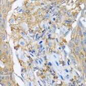 Anti-RALBP1 Antibody, clone 5C10W9, Rabbit Monoclonal