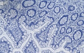 Anti-PTBP1/PTB Antibody, clone 1G23 ZooMAb® Rabbit Monoclonal recombinant, expressed in HEK 293 cells