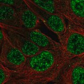 Anti-PLAG1 antibody produced in rabbit Prestige Antibodies® Powered by Atlas Antibodies, affinity isolated antibody
