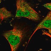 Anti-GBA2 antibody produced in rabbit Prestige Antibodies® Powered by Atlas Antibodies, affinity isolated antibody, buffered aqueous glycerol solution