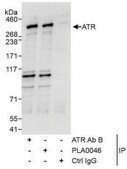 Rabbit anti-ATR Antibody, Affinity Purified Powered by Bethyl Laboratories, Inc.
