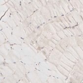 Anti-CTNNB1 antibody produced in rabbit Prestige Antibodies® Powered by Atlas Antibodies, affinity isolated antibody, buffered aqueous glycerol solution, ab2