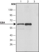 Anti-Glucocerebrosidase antibody produced in rabbit ~1 mg/mL, affinity isolated antibody, buffered aqueous solution