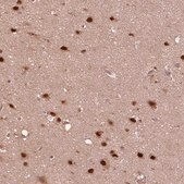 Anti-PSMC5 antibody produced in rabbit Prestige Antibodies® Powered by Atlas Antibodies, affinity isolated antibody