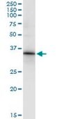 Monoclonal Anti-HOXC8 antibody produced in mouse clone 1H2, purified immunoglobulin, buffered aqueous solution