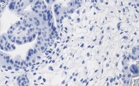 Anti-FCGR2B/CD32 Antibody, clone 3G17 ZooMAb® Rabbit Monoclonal recombinant, expressed in HEK 293 cells