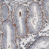 Monoclonal Anti-LAMC1 antibody produced in mouse Prestige Antibodies® Powered by Atlas Antibodies, clone CL3196, purified immunoglobulin, buffered aqueous glycerol solution