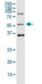 Monoclonal Anti-ODC1 antibody produced in mouse clone 2G5, purified immunoglobulin, buffered aqueous solution