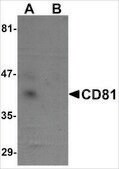 Anti-CD81 antibody produced in rabbit affinity isolated antibody, buffered aqueous solution