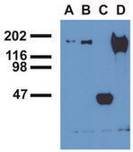 Monoclonal Anti-EGFR (PhosphoTyr1173) antibody produced in mouse clone EM-13