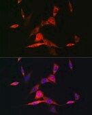 Anti-RARβ Antibody, clone 6D5V4, Rabbit Monoclonal