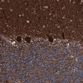 Anti-TRIM7 antibody produced in rabbit Prestige Antibodies® Powered by Atlas Antibodies, affinity isolated antibody, buffered aqueous glycerol solution