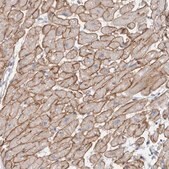 Anti-DMD antibody produced in rabbit Prestige Antibodies® Powered by Atlas Antibodies, affinity isolated antibody, buffered aqueous glycerol solution