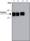 Anti-TIMP2 antibody, Mouse monoclonal clone TM8, purified from hybridoma cell culture