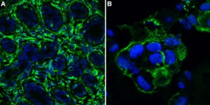 抗波形蛋白抗体，克隆V9 clone V9, Chemicon®, from mouse