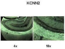 Anti-KCNN2 antibody produced in rabbit IgG fraction of antiserum