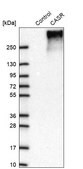 Anti-CASR antibody produced in rabbit Prestige Antibodies® Powered by Atlas Antibodies, affinity isolated antibody, buffered aqueous glycerol solution