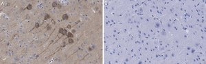 Anti-NMDAR2B Antibody, clone 5C18 ZooMAb® Rabbit Monoclonal recombinant, expressed in HEK 293 cells