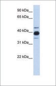 Anti-HNRNPC antibody produced in rabbit affinity isolated antibody