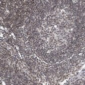 Anti-TAF8 antibody produced in rabbit Prestige Antibodies® Powered by Atlas Antibodies, affinity isolated antibody, buffered aqueous glycerol solution