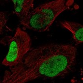 Anti-SOX2 antibody produced in rabbit Prestige Antibodies® Powered by Atlas Antibodies, affinity isolated antibody