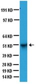 Anti-Glial Fibrillary Acidic Protein Antibody, clone GA5 clone GA5, Chemicon®, from mouse