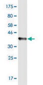 Monoclonal Anti-RHOT1 antibody produced in mouse clone 1A12, purified immunoglobulin, buffered aqueous solution
