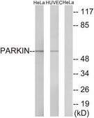 Anti-Parkin antibody produced in rabbit affinity isolated antibody