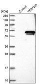 Anti-TERF2IP antibody produced in rabbit Prestige Antibodies® Powered by Atlas Antibodies, affinity isolated antibody, buffered aqueous glycerol solution