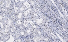 Anti-PP2A C subunit Antibody, clone 2B15 ZooMAb® Rabbit Monoclonal recombinant, expressed in HEK 293 cells