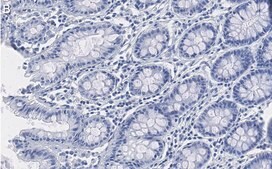 Anti-NME1 Antibody, clone 1H15 ZooMAb® Rabbit Monoclonal recombinant, expressed in HEK 293 cells