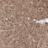 Anti-OGT antibody produced in rabbit Prestige Antibodies® Powered by Atlas Antibodies, affinity isolated antibody, buffered aqueous glycerol solution, ab1