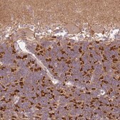 Anti-PRKAA2 antibody produced in rabbit Prestige Antibodies® Powered by Atlas Antibodies, affinity isolated antibody, buffered aqueous glycerol solution