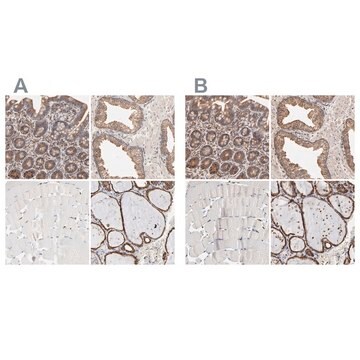 Anti-PDIA3 antibody produced in rabbit Ab2, Prestige Antibodies® Powered by Atlas Antibodies, affinity isolated antibody, buffered aqueous glycerol solution