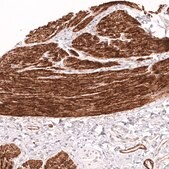 Monoclonal Anti-Myh11 Antibody Produced In Mouse Prestige Antibodies® Powered by Atlas Antibodies, clone CL14617, affinity isolated antibody, buffered aqueous glycerol solution