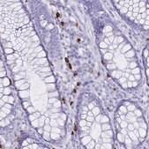 Anti-IL2RB antibody produced in rabbit Prestige Antibodies® Powered by Atlas Antibodies, affinity isolated antibody, buffered aqueous glycerol solution