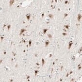 Anti-PRDM2 antibody produced in rabbit Prestige Antibodies® Powered by Atlas Antibodies, affinity isolated antibody, buffered aqueous glycerol solution