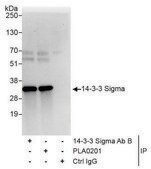 Rabbit anti-14-3-3 Sigma Antibody, Affinity Purified Powered by Bethyl Laboratories, Inc.
